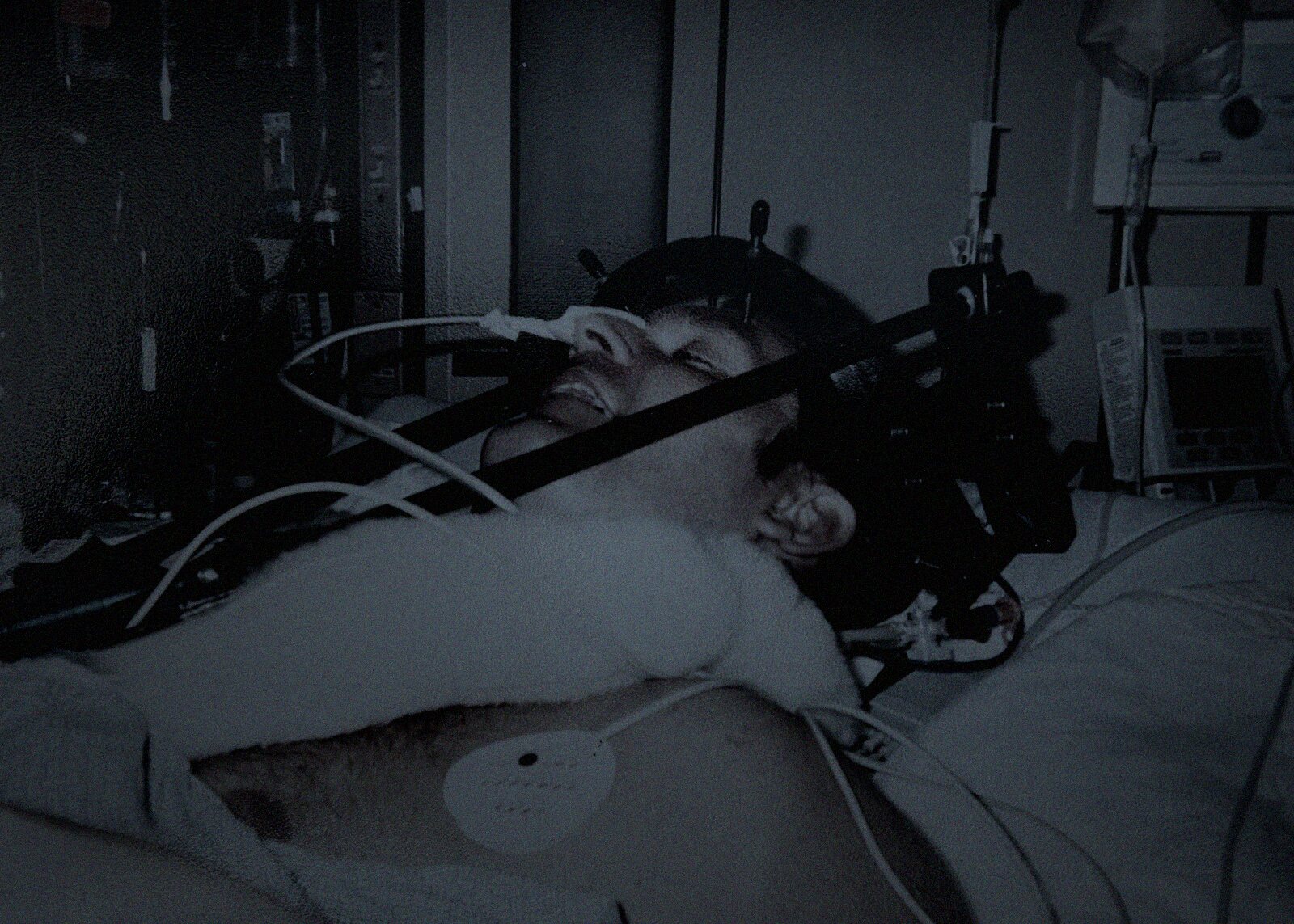 Archival photograph of Richard in intensive care, held in a halo brace after the accident.